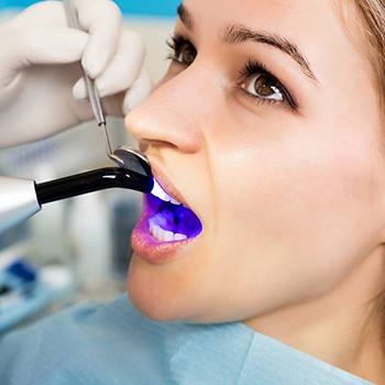 Dentist completing cosmetic dental bonding treatment