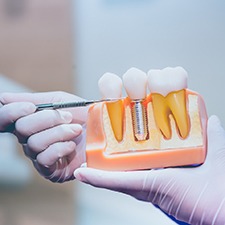 Dentist pointing to different parts of dental implant in Allen
