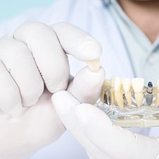 A gloved hand holding a single dental implant