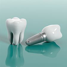 Animated implant supported dental crown compared with natural tooth