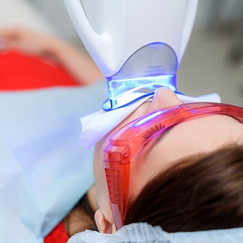 Closeup of woman undergoing teeth whitening treatment