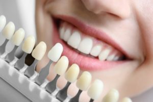 What Does the Color of Your Teeth Say About You?