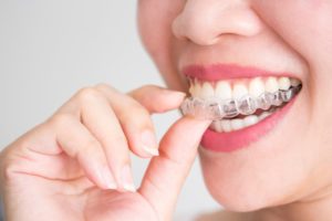 woman putting on an Invisalign tray