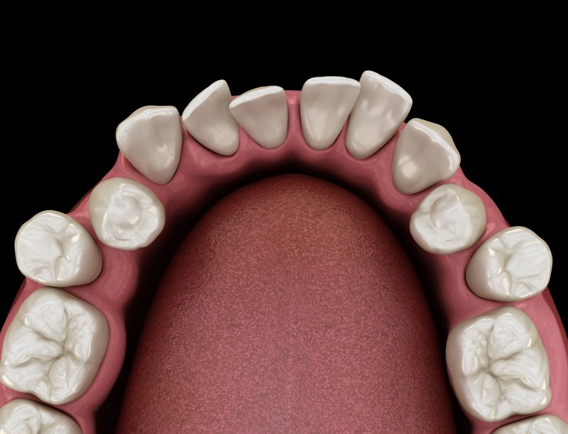 3-D diagram of a crooked smile 