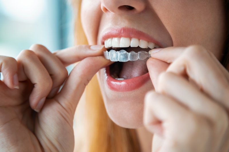 young woman smiling and holding an Invisalign aligner